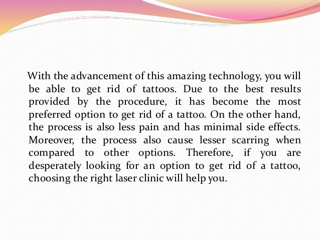 laser tattoo removal can be easy and effective laser tattoo removal can be easy and effective