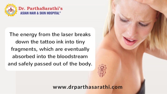 laser treatment for tattoo removal in bangalore treatment for skin u2026 laser treatment for tattoo removal in bangalore treatment for skin u2026