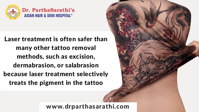 laser treatment for tattoo removal in bangalore treatment for skin u2026 laser treatment for tattoo removal in bangalore treatment for skin u2026