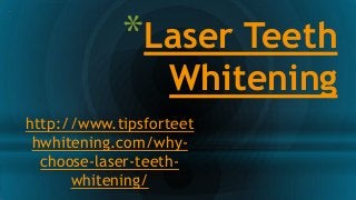 *Laser Teeth
Whitening
http://www.tipsforteet
hwhitening.com/why-
choose-laser-teeth-
whitening/
 