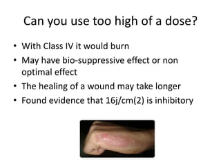 Can you use too high of a dose?
• With Class IV it would burn
• May have bio-suppressive effect or non
  optimal effect
• The healing of a wound may take longer
• Found evidence that 16j/cm(2) is inhibitory
 