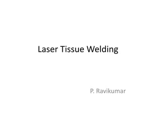 Laser Tissue Welding
P. Ravikumar
 
