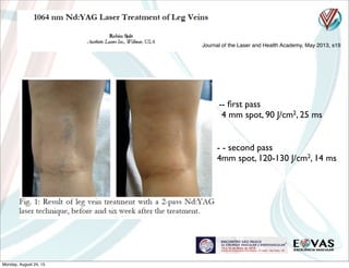 Journal of the Laser and Health Academy, May 2013, s19
-- ﬁrst pass
4 mm spot, 90 J/cm2, 25 ms
- - second pass
4mm spot, 120-130 J/cm2, 14 ms
Monday, August 24, 15
 