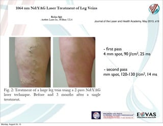 Journal of the Laser and Health Academy, May 2013, s19
-- ﬁrst pass
4 mm spot, 90 J/cm2, 25 ms
- - second pass
4mm spot, 120-130 J/cm2, 14 ms
Monday, August 24, 15
 
