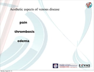 Aesthetic aspects of venous disease
pain
thrombosis
edema
Monday, August 24, 15
 