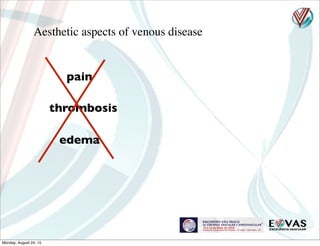 Aesthetic aspects of venous disease
pain
thrombosis
edema
Monday, August 24, 15
 