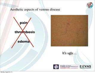 Aesthetic aspects of venous disease
pain
thrombosis
edema
It's ugly…
Monday, August 24, 15
 