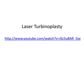 Laser Turbinoplasty
http://www.youtube.com/watch?v=JScSuBAR_Gw
 