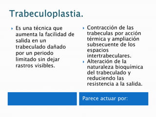 Trabeculoplastia selectiva.