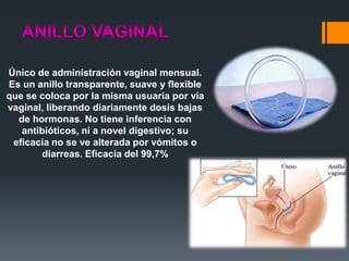 Único de administración vaginal mensual.
Es un anillo transparente, suave y flexible
que se coloca por la misma usuaria por vía
vaginal, liberando diariamente dosis bajas
de hormonas. No tiene inferencia con
antibióticos, ni a novel digestivo; su
eficacia no se ve alterada por vómitos o
diarreas. Eficacia del 99,7%
 
