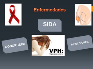 SIDA
 