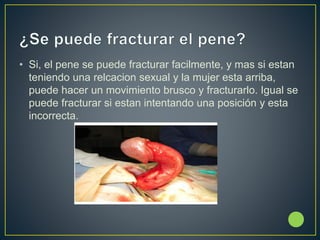La sexualidad segura2