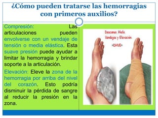 ¿Cómo pueden tratarse las hemorragias
con primeros auxilios?
Compresión: Las
articulaciones pueden
envolverse con un vendaje de
tensión o media elástica. Esta
suave presión puede ayudar a
limitar la hemorragia y brindar
soporte a la articulación.
Elevación: Eleve la zona de la
hemorragia por arriba del nivel
del corazón. Esto podría
disminuir la pérdida de sangre
al reducir la presión en la
zona.
 