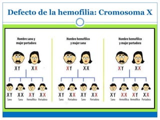 Defecto de la hemofilia: Cromosoma X
 