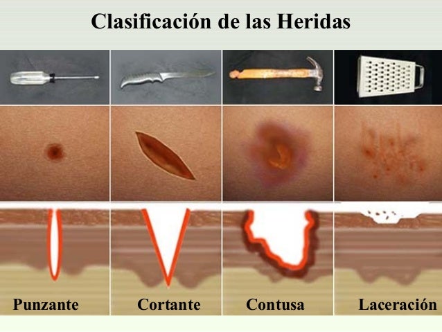Atencion basica a los lesionados por golpes, heridas y fracturas