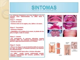 Teoría del intercambio colombino.