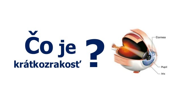 Čo je
krátkozrakosť ?
 
