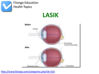 Fitango Education
          Health Topics

                                  LASIK




http://www.fitango.com/categories.php?id=316
 