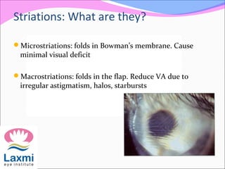 Striations: What are they?
Microstriations: folds in Bowman’s membrane. Cause
minimal visual deficit
Macrostriations: folds in the flap. Reduce VA due to
irregular astigmatism, halos, starbursts
 