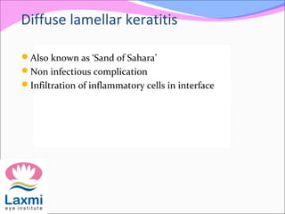 Diffuse lamellar keratitis
Also known as ‘Sand of Sahara’
Non infectious complication
Infiltration of inflammatory cells in interface
 