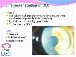 Stage 2
Whitish cells of granular or wave like appearance in
visual axis and possibly at the periphery
Typically seen 2 or 3 days post Lasik
No decrease in BCVA
Mx:
Frequent
administration of
topical steroids
Linebarger staging of DLK
 