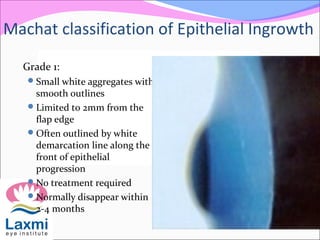 Machat classification of Epithelial Ingrowth
Grade 1:
Small white aggregates with
smooth outlines
Limited to 2mm from the
flap edge
Often outlined by white
demarcation line along the
front of epithelial
progression
No treatment required
Normally disappear within
2-4 months
 