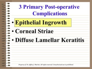 3 Primary Post-operative
       Complications
• Epithelial Ingrowth
• Corneal Striae
• Diffuse Lamellar Keratitis


  Property	
  of	
  	
  Dr.	
  Jeﬀery	
  J.	
  Machat.	
  All	
  rights	
  reserved.	
  Unauthorized	
  use	
  is	
  prohibited.
                                                                                                                               	
  
 