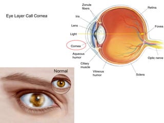 Eye Layer Call Cornea
 