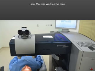 Laser Machine Work on Eye Lens.
 