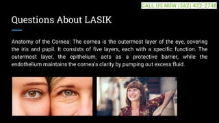 Questions About LASIK
Anatomy of the Cornea: The cornea is the outermost layer of the eye, covering
the iris and pupil. It consists of five layers, each with a specific function. The
outermost layer, the epithelium, acts as a protective barrier, while the
endothelium maintains the cornea's clarity by pumping out excess fluid.
CALL US NOW (562) 432-2748
 