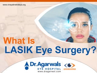 What Is
LASIK Eye Surgery?
www.vinayaknetralaya.org
w w w. d r a g a r w a l . c o m
 