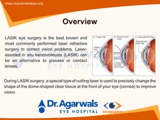 Lasik Surgeon in Indore | Lasik Treatment in Indore | Vinayak Netralaya ...
