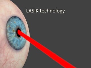 LASIK technology 