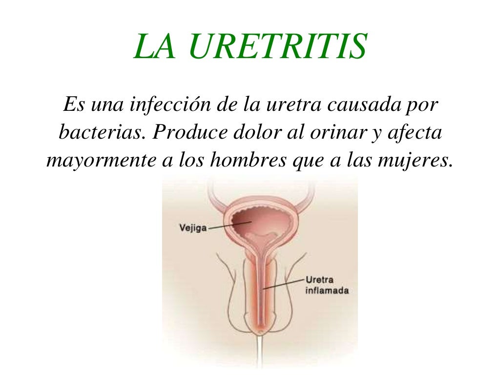 Las infecciones
