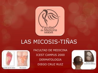 LAS MICOSIS-TIÑAS
   FACULTAD DE MEDICINA
    ICEST CAMPUS 2000
      DERMATOLOGIA
     DIEGO CRUZ RUIZ
 
