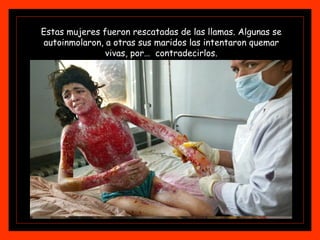 Estas mujeres fueron rescatadas de las llamas. Algunas se autoinmolaron, a otras sus maridos las intentaron quemar vivas, por…  contradecirlos. 