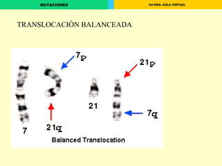 TRANSLOCACIÓN BALANCEADA 