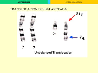 TRANSLOCACIÓN DESBALANCEADA 