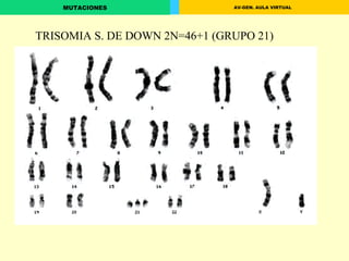 TRISOMIA S. DE DOWN 2N=46+1 (GRUPO 21) 
