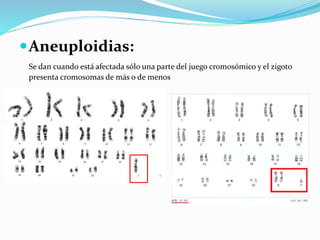 Aneuploidias:
Se dan cuando está afectada sólo una parte del juego cromosómico y el zigoto
presenta cromosomas de más o de menos
 