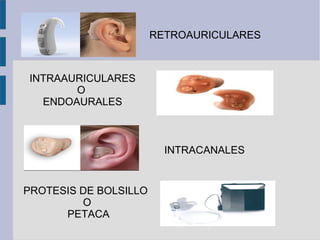 RETROAURICULARES



INTRAAURICULARES
       O
  ENDOAURALES



                         INTRACANALES


PROTESIS DE BOLSILLO
         O
      PETACA
 
