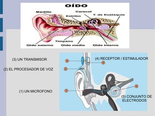 (3) UN TRANSMISOR      (4) RECEPTOR / ESTIMULADOR


(2) EL PROCESADOR DE VOZ




       (1) UN MICROFONO
                                       (5) CONJUNTO DE
                                        ELECTRODOS
 