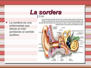 La sordera
   La sordera es una
    enfermedad que
    afecta al oído
    perdiendo el sentido
    auditivo.
 