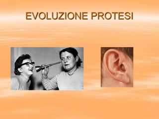 EVOLUZIONE PROTESI
 