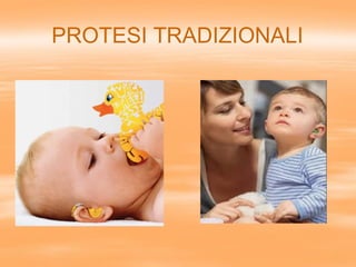 PROTESI TRADIZIONALI
 