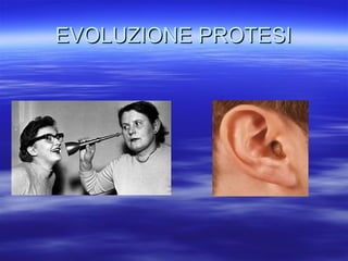 EVOLUZIONE PROTESI

 
