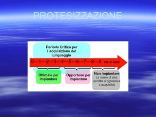 PROTESIZZAZIONE

 