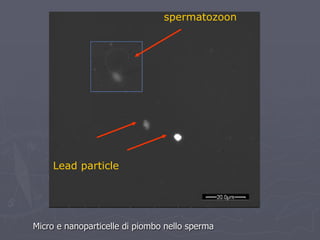Micro e nanoparticelle di piombo nello sperma
spermatozoon
Lead particle
 