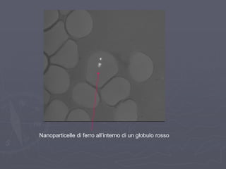 Nanoparticelle di ferro all‟interno di un globulo rosso
 