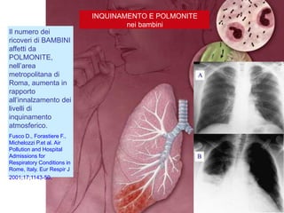 Il numero dei
ricoveri di BAMBINI
affetti da
POLMONITE,
nell‟area
metropolitana di
Roma, aumenta in
rapporto
all‟innalzamento dei
livelli di
inquinamento
atmosferico.
Fusco D., Forastiere F.,
Michelozzi P.et al. Air
Pollution and Hospital
Admissions for
Respiratory Conditions in
Rome, Italy. Eur Respir J
2001;17;1143-50.
INQUINAMENTO E POLMONITE
nei bambini
 